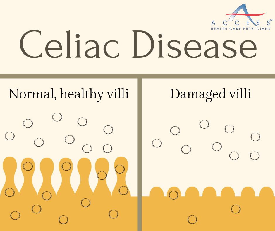 celiac disease